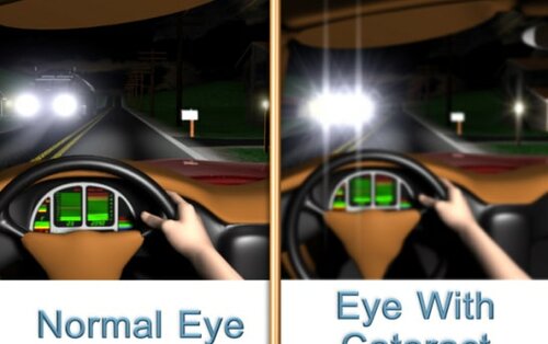 Vergleichsbild: normales Sehen und eingeschränktes Sehen bei Grauem Star (Katarakt) – Darstellung beim Autofahren