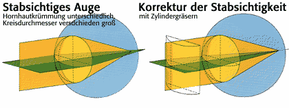 stabsichtiges-auge